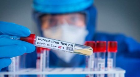 TƏBİB-dən koronavirus testlərinin fərqli nəticələr göstərməsinə MÜNASİBƏT 