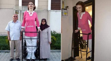 Türkiyənin ən uzun boylu qadını “Ginnesin rekordlar kitabı”na düşdü