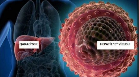 Qaş düzəltmək istəyəndə Göz çıxaranlar - Azərbaycanda HEPATİT necə yayılır? - VİDEOREPORTAJ