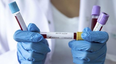 Azərbaycanda son gündə 585 nəfər koronavirusa yoluxdu - 1 xəstə öldü