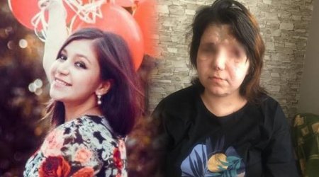 “Kiçik qızımı ən son 4 aylığında görmüşəm” – Gəncə terrorunda gözlərini itirmiş Pərvin Qasımova 