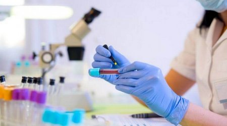 Azərbaycana yeni virusu aşkar edən testlər gətirildi