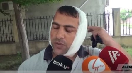 “Bir də gördüm, qulağım yoxdur…” – Qulağını eşşək qopardan kişi danışdı + VİDEO