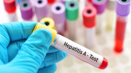 Mingəçevirdə hepatit A xəstəsi Bakıdakı xəstəxanada qızılcaya YOLUXUB? – TƏBİB-dən AÇIQLAMA 