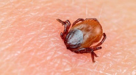 Çində növbəti öldürücü virus: Gənə ilə ötürülərək beyində...