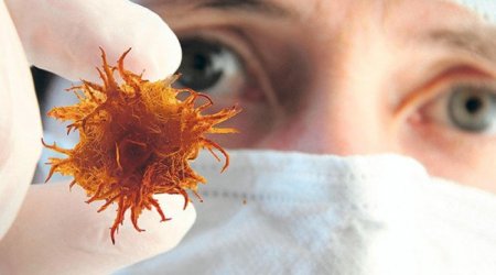 Rusiyada naməlum virus YAYILIR – Həftələrlə davam edən öskürək, boğazdan qan gəlməsi...