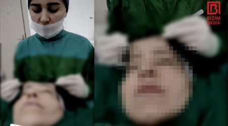 Xəstənin dərisini əlində tutan cərrahla bağlı ARAŞDIRMA BAŞLADI – VİDEO