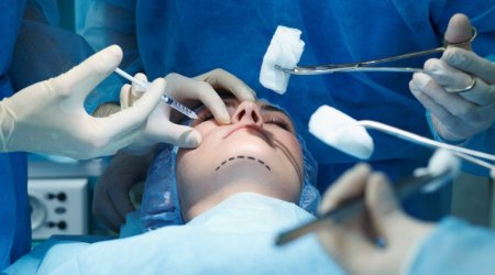 Azərbaycanda plastik cərrahiyyə üzrə icazə verilən əməliyyatların SİYAHISI
