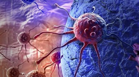 Xərçəng xəstəliyinin yeni müalicə üsulu KƏŞF OLUNDU