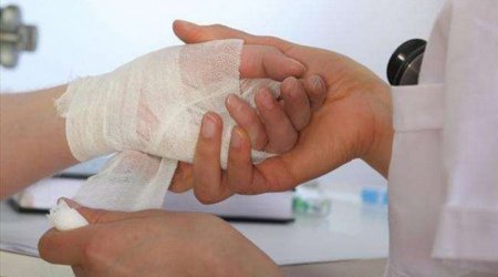 Gəncədə qadın özünə xəsarət yetirdi