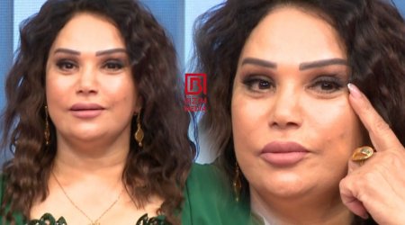 Mənzurə həkimdən şikayətçidir: “Üzümün bir tərəfini dartıb, o birini yox” - VİDEO