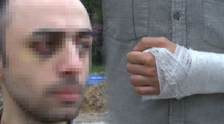 Türkiyədə azərbaycanlı tələbəni döyüb videoya çəkənlərə AĞIR CƏZA – FOTO