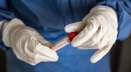 Koronavirus yenidən baş qaldırdı – Yoluxmalar sürətlə ARTIR