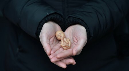 Qanunsuz aborta görə cəzalar SƏRTLƏŞDİRİLİR