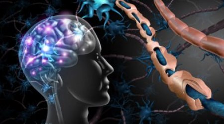 Gəncləri belə ölümə aparan SKLEROZ – “Günəş ölkəsi”ndə D vitamini çatışmazlığı niyə artıb?
