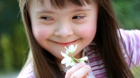 Daun sindromu bu üsulla müalicə oluna bilər