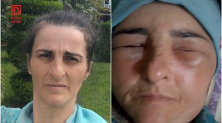 Lənkəranda qonşular arasında dava: Fiziki qüsurlu qadın xəsarət aldı – FOTO