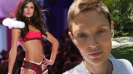 Xərçəng xəstəsi olan model podiuma BURAXILMADI