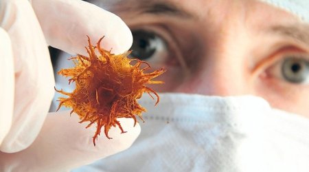 Elmdə sensasiya: Xərçəngin 50 növü bir testlə aşkarlanacaq