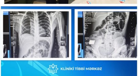 Bakıda 17 yaşlı yeniyetmə taxta UDDU – FOTO