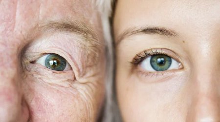 Bu şəxslər tez qocalır