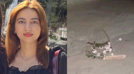 “Əməliyyatdan sonra adam görəndə qorxurdu, evə qapanmışdı” – VİDEO