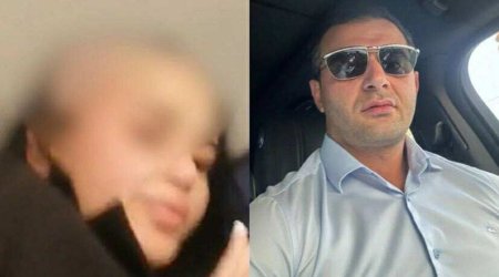 Arvadının saçını keçəl edən ər HƏBS OLUNDU