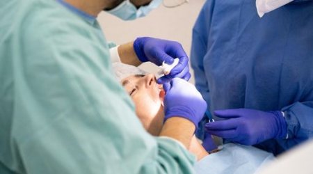 Diş müalicəsi bu xəstəliklərin riskini azaldır - ARAŞDIRMA