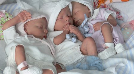 Qubada 20 yaşlı ana üçəm dünyaya gətirdi &ndash; Vaxtından əvvəl doğulan körpələrin SON DURUMU 