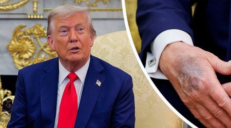 Tramp etiraf etdi: Əlini makiyaj edir – FOTO