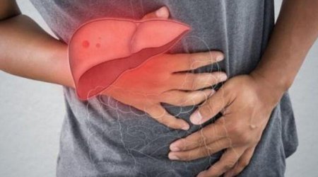 ABŞ-da xəstələr üçün hipoimmun 3D-çaplı qaraciyər hazırlanır - İXTİRA