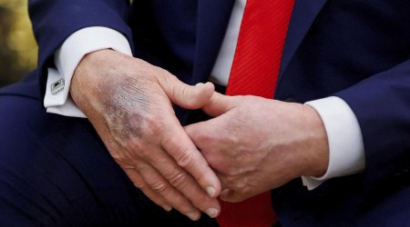 Yenə əlləri ilə gündəm oldu