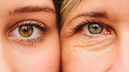 Daha gec qocalmaq istəyirsiniz? - Bu qidalar köməyinizə çatacaq