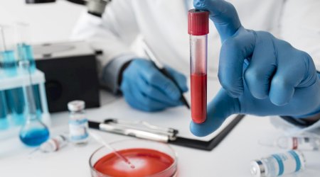 Ən uzunömürlü qan qrupu açıqlandı