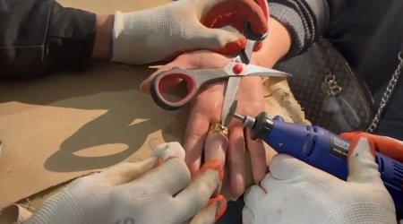 Barmağında sıxışan üzüyü belə çıxardılar &ndash; VİDEO