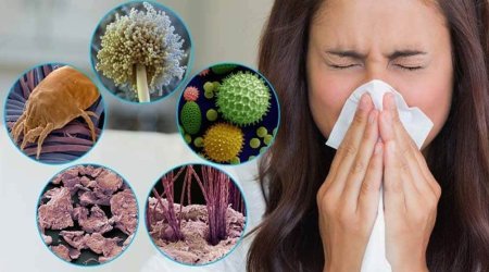 Bu tarixə qədər hər iki insandan birində allergiya olacaq &ndash; ŞOK XƏBƏRDARLIQ