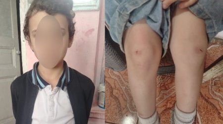 İki şagirdin məktəbin ayaqyolunda mütəmadi döyülməsi ilə bağlı RƏSMİ AÇIQLAMA