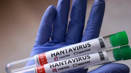 Dünyanı qorxuya salan hantavirus bu şəkildə YAYILIR &ndash; Daha bir XƏBƏRDARLIQ