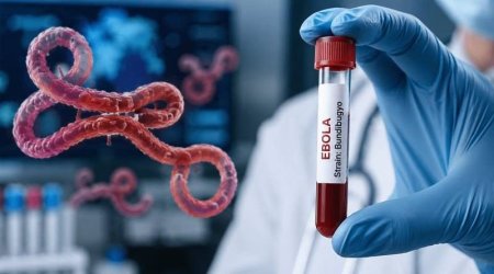 Ebola təhlükəsi - Avstriya sakinində də simptomlar aşkarlandı