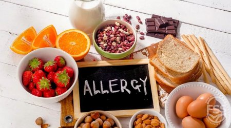 Son zamanlar geniş yayılmış qida allergiyasının səbəbləri bəlli oldu &ndash; MÜSAHİBƏ