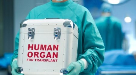 Sümük iliyi transplantasiyasına ehtiyacı olan xəstələrin SAYI AÇIQLANDI &ndash;RƏSMİ