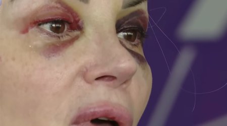 &ldquo;Mən ondan həmişə qorxmuşam...&rdquo;- Həmin kişi eks-iş yoldaşı imiş &ndash; Video