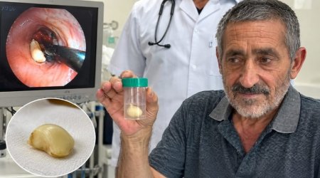 6 ay ağciyərində bu bitki ilə yaşadı &ndash; həqiqət xəstəxanada üzə çıxdı