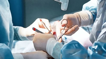 Qanunsuz plastik əməliyyatlar aparan 3 cərrah CƏZALANDIRILDI, 22 klinika cərimələndi &ndash; RƏSMİ