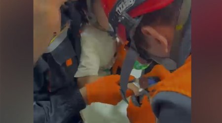 4 yaşlı uşağın barmağında dəmir halqa qaldı - VİDEO
