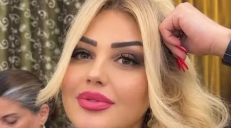 Bakıda qadın dişini çəkdirdiyinə görə vəfat edib? &ndash; Video